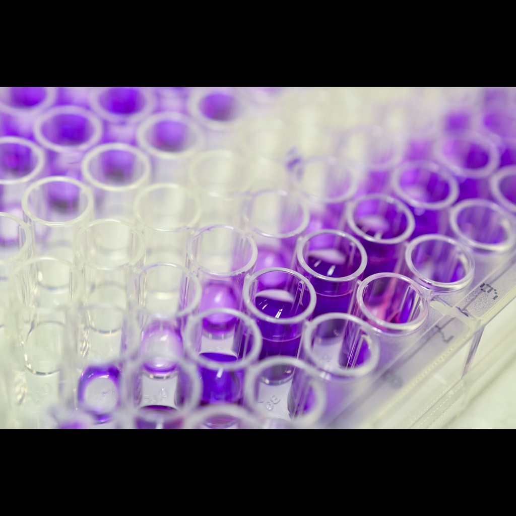 Human Hepatitis C virus IgM,HCVsize:IgM ELISA Kit  Quantitative , 96 tests